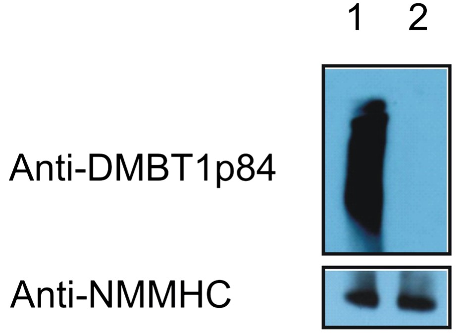 DMBT1 expression in DMBT1 cells.jpg